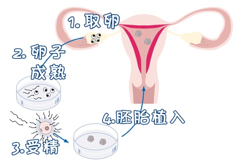 景泰生殖医学中心